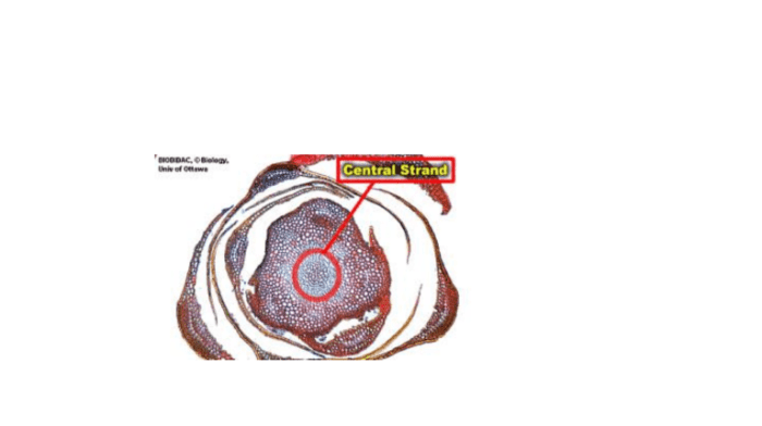 Xylem elements