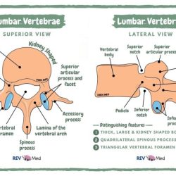 Lumbar vertebrae lateral view labeled