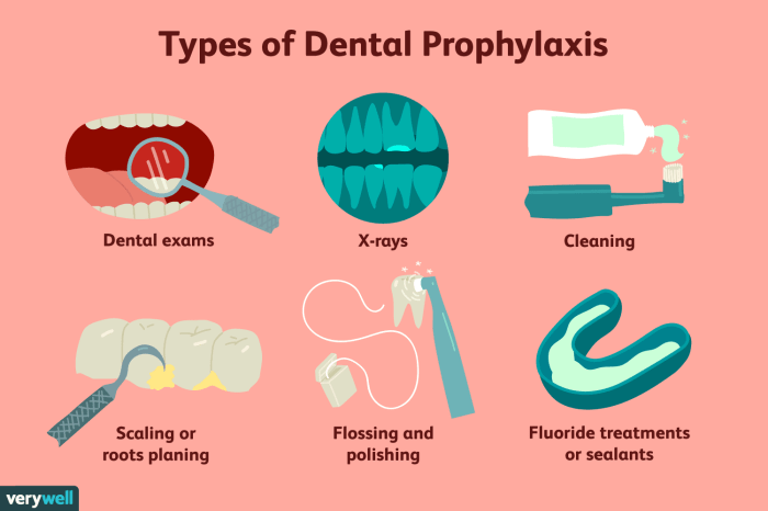 Explain the difference between a prophylaxis and coronal polishing